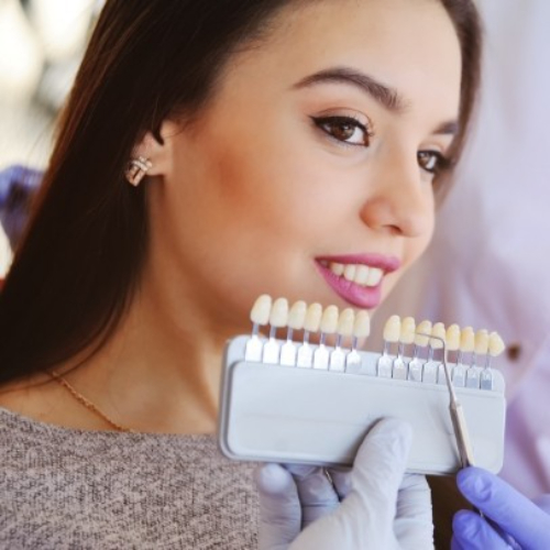 Dental Veneers, dental veneers in sahakar nagar, dentists with veneers in sahakara nagar, permanent dental veneers in sahakarnagar, porcelain veneers in sahakar nagar, treatment for fractured teeth in sahakarnagar