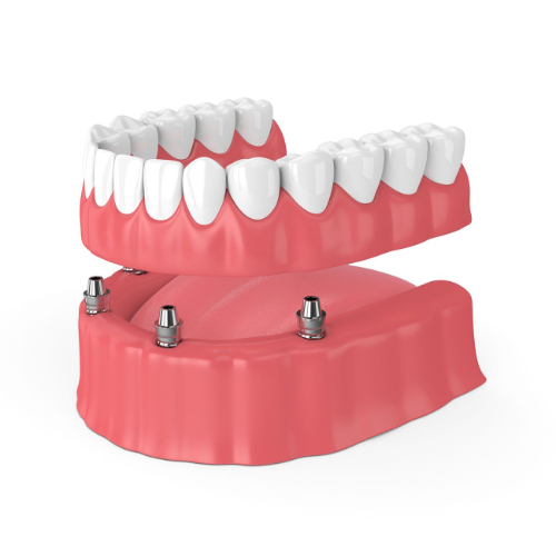 best dentures service doctor in sahakara nagar, cost of dentures sahakara nagar, denture fixing services in sahakara nagar, dentures in sahakara nagar, dentures specialist in sahakara nagar, fixed full dentures treatment sahakara nagar, fixed prosthetic dentures in sahakarnagar