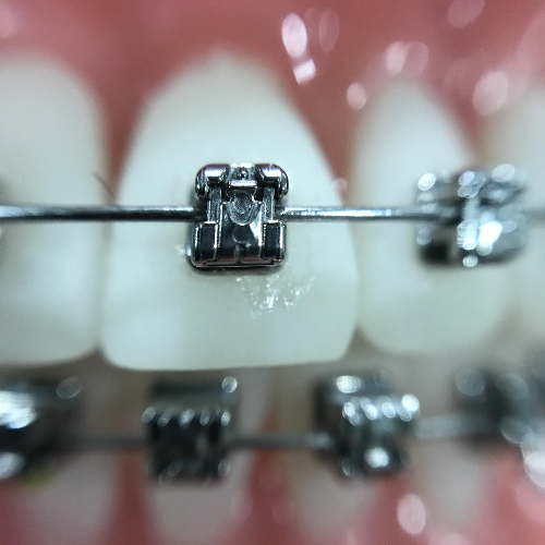 best dental chain sahakara nagar, best dental clinic, best dental clinic in sahakara nagar, best dental clinic in sahakaranagar, best dental hospital in sahakara nagar, best dentist in sahakaranagar, dental clinic in sahakara nagar, dental clinic in sahakarnagar, dental solutions clinic in sahakara nagar, dental solutions in sahakara nagar, dental treatment in sahakara nagar, famous dental hospital in sahakara nagar