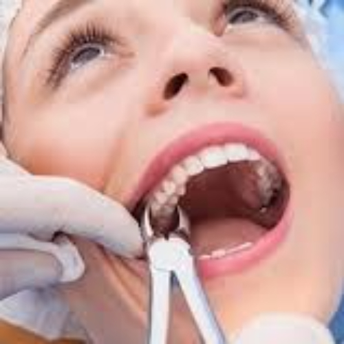 dentist for wisdom tooth removal in sahakara nagar, molar tooth extraction in sahakara nagar, painless tooth extraction in sahakarnagar, tooth extraction cost in sahakara nagar, tooth extraction in sahakara nagar, tooth extractions doctors in sahakara nagar, tooth removal in sahakara nagar, wisdom tooth extraction in sahakara nagar, wisdom tooth removal in sahakara nagar